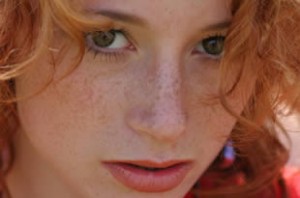 Лечение пигментации